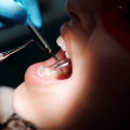 Sedation Dentistry Unveiled: Your Pathway To Painless Dental Implants In Ashburn, VA