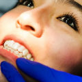 Sedation Dentistry And Dental Crowns: The Perfect Combination For A Relaxing And Restorative Dental Visit In Manassas Park, VA