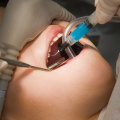 Does Intravenous Sedation Make You Sleep During Dental Treatment?