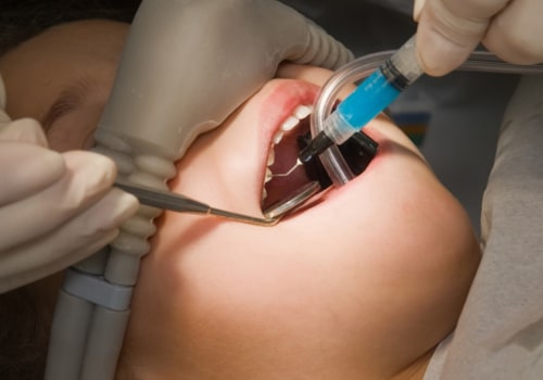 Is IV Sedation Safe for Dental Work?
