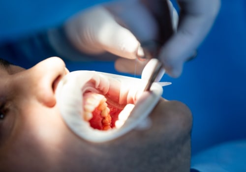 Say Goodbye To Dental Anxiety: How Sedation Dentistry Makes Dental Implants In Waco A Breeze
